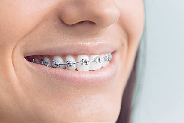 Best Full Mouth Reconstruction  in Helena Valley Southeast, MT